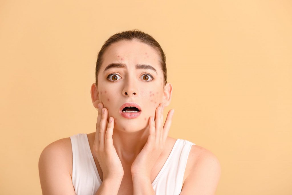 How Stress Affects Your Skin_ What You Need To Know